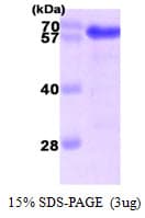 Human Harmonin / USH1C Protein (Recombinant His)