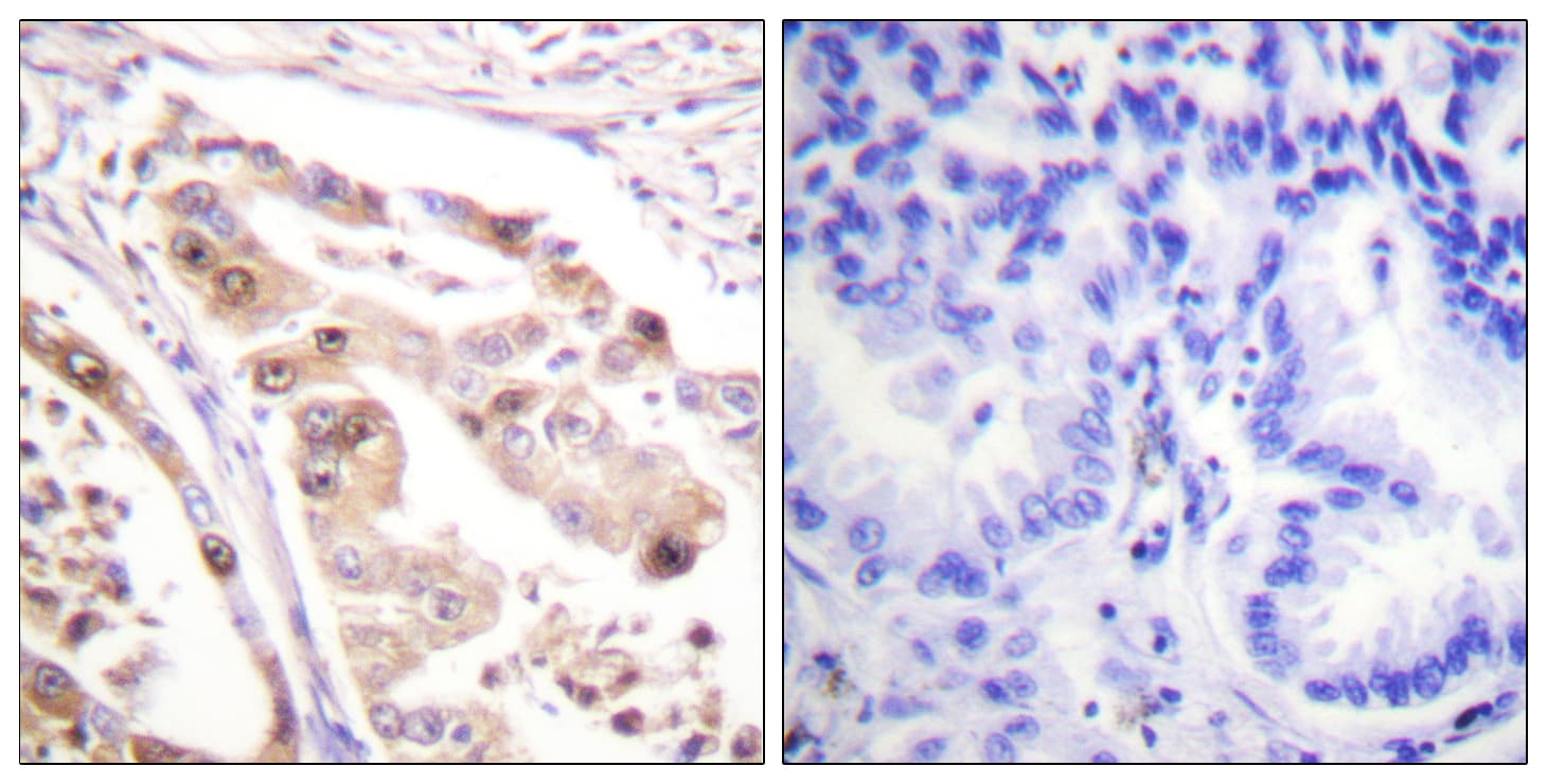 RPA2 / RFA2 / RPA34 Antibody (aa10-59)