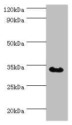 TRADD Antibody (aa1-312)