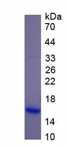 Mouse ACE / CD143 Protein (Recombinant His-S)