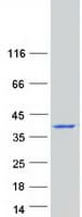 Human CALY Protein (Recombinant Myc-DDK (Flag))
