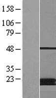 MCAT Protein (Over-Expression Lysate Myc-DDK (Flag))