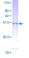 Human RGS17 / RGSZ2 Protein (Recombinant GST)