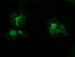 STK38L / NDR2 Antibody (clone OTI4D8)