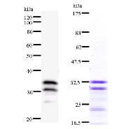 Monoclonal Mouse anti-Human TUBD1 / Tubulin Delta Antibody (clone 3183C3a, WB)