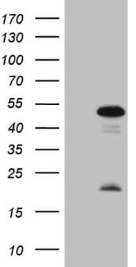 MKX Antibody (clone OTI6B9, Carrier-free)