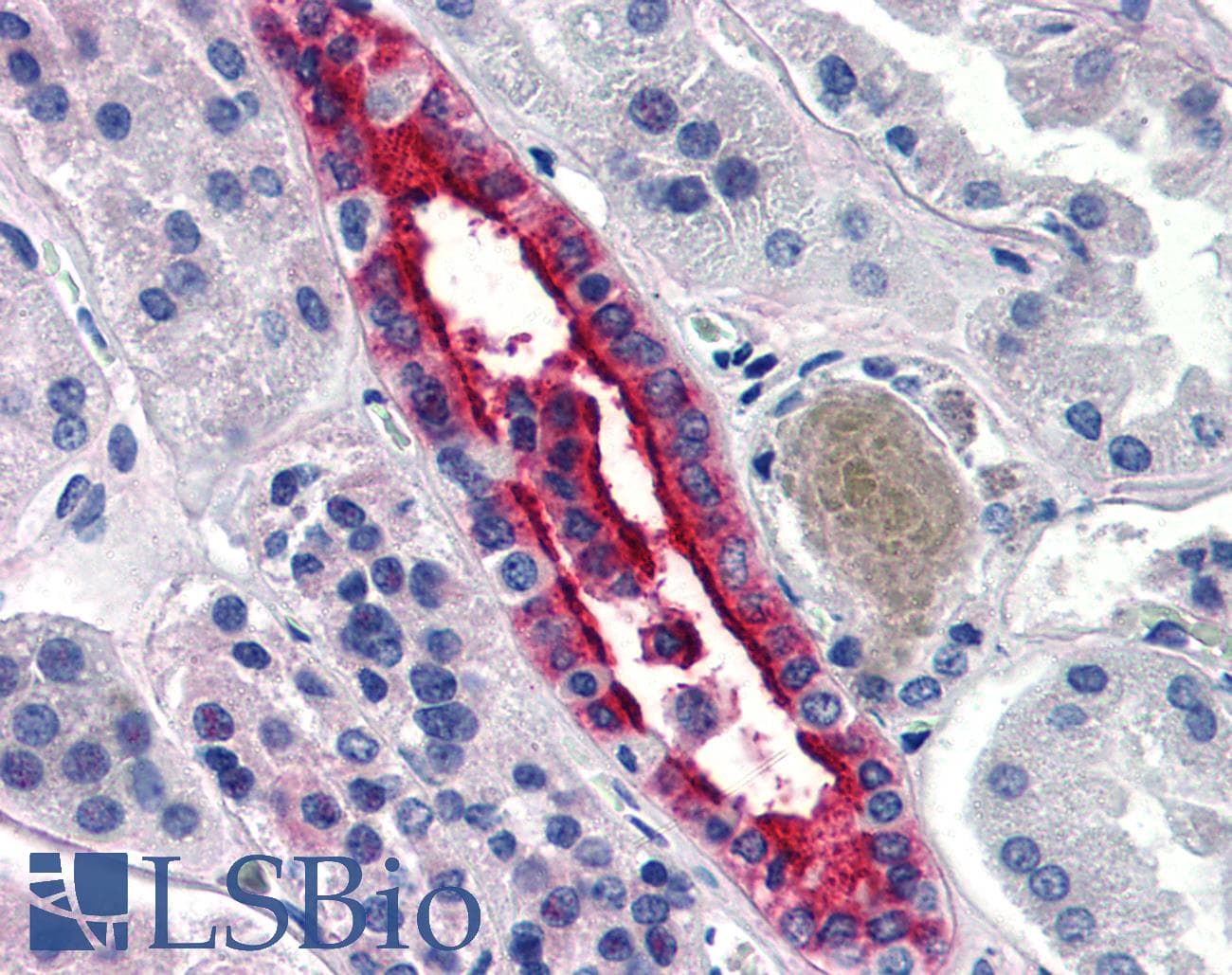 IHC-plus™ Polyclonal Rabbit anti-Human AQP2 / Aquaporin 2 Antibody (C-Terminus, IHC, WB)