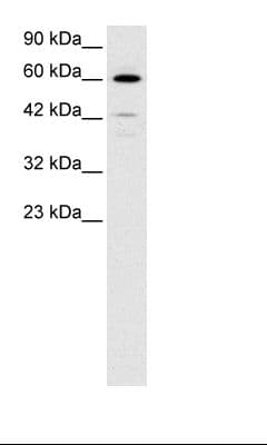 HDAC2 Antibody (aa419-468)