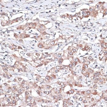 Polyclonal Rabbit anti-Human TGFBR2 Antibody (IHC, IF)