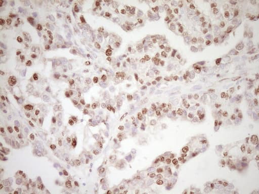 LPIN1 / Lipin 1 Antibody (clone OTI8F10)