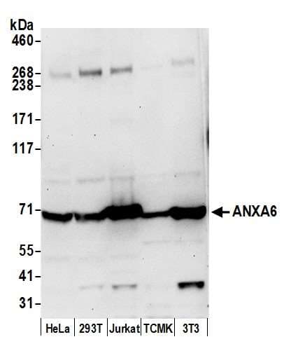 ANXA6/Annexin A6/Annexin VI Antibody (aa525-575)