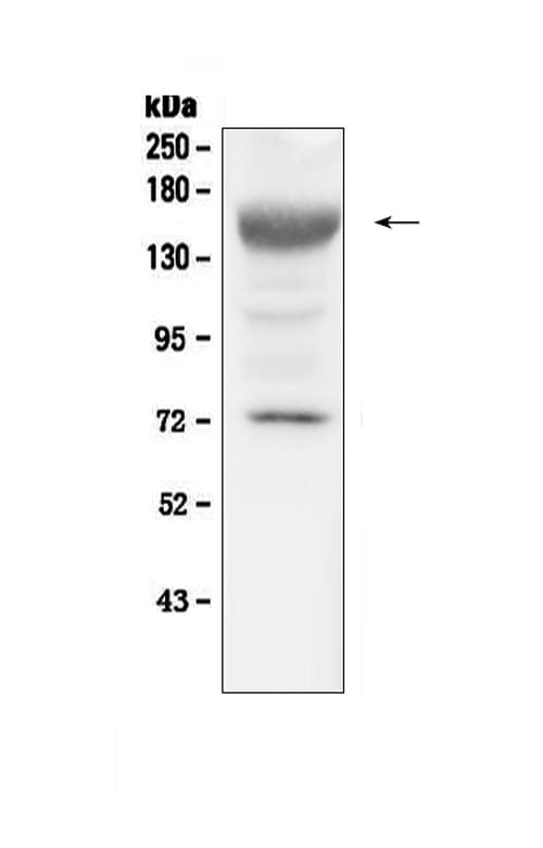 IGF1R / IGF1 Receptor Antibody