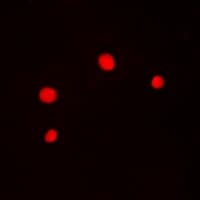 GABPB1 Antibody