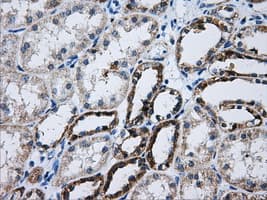 ATP5B / ATP Synthase Beta Antibody (clone OTI6B11)