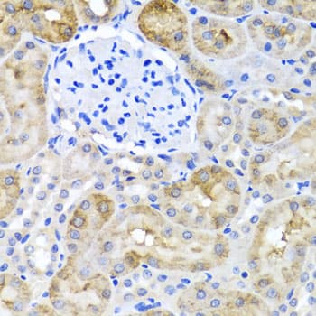 SULT1A1 / Sulfotransferase 1A1 Antibody