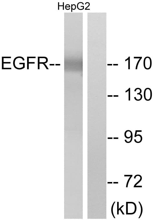 EGFR Antibody (aa1077-1126)