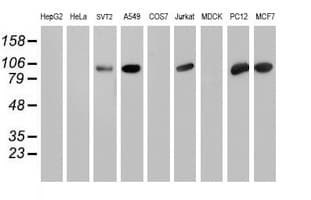 PFKP Antibody (clone OTI1D6)