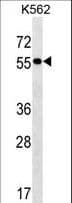 Polyclonal Rabbit anti-Human FRMD8 Antibody (aa74-100, WB)