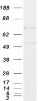 Human DNAI1 Protein (Recombinant Myc-DDK (Flag))