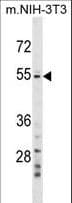GPT2 / ALT2 Antibody (aa15-44)