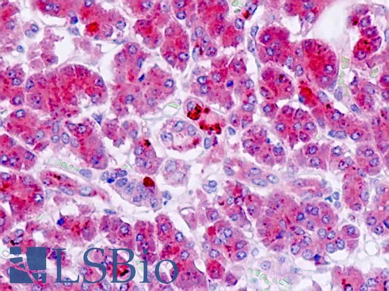 IHC-plus™ Polyclonal Rabbit anti-Human GPR142 Antibody (aa1-50, IHC, IF, WB)