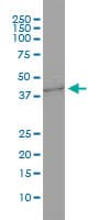 Monoclonal Mouse anti-Human GNB3 Antibody (clone M1-1-1D5, IF, WB)