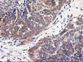 HARS2 Antibody (clone OTI6F9, Carrier-free)