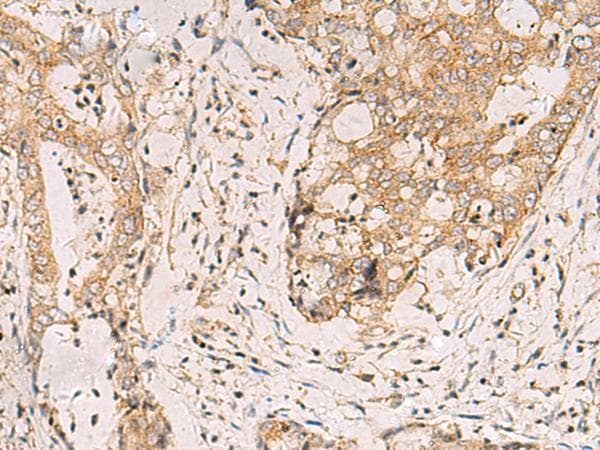 FYCO1 Antibody