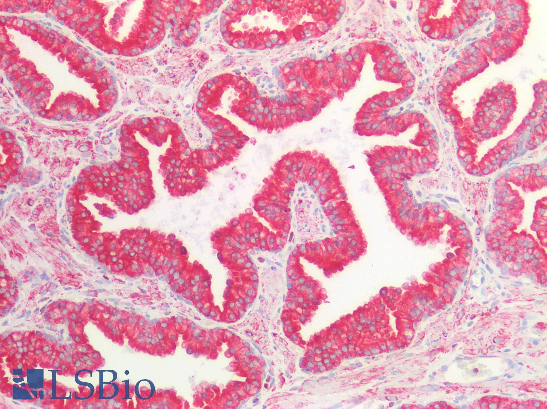 PathPlus™ CANX / Calnexin Antibody