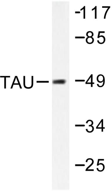 Polyclonal Rabbit anti-Human MAPT / Tau Antibody (Thr175, WB)