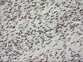 TYRO3 Antibody (clone OTI4C8)