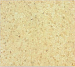 EME1 Antibody (aa1-583)