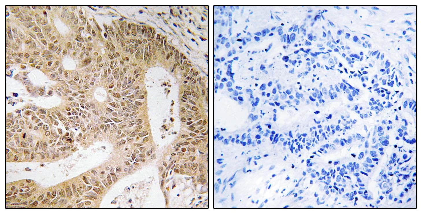 DAP Antibody