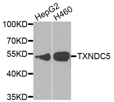 TXNDC5 / ERP46 Antibody