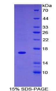 Rat ITGAM / CD11b Protein (Recombinant His)