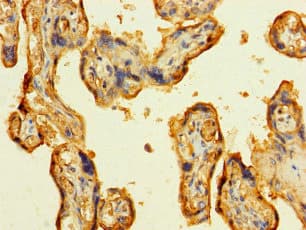 LAMA5 / Laminin Alpha 5 Antibody