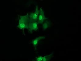 UBE2S / E2 EPF Antibody (clone OTI4G2)