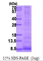 Human EREG / Epiregulin Protein (Recombinant His)