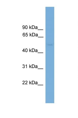 PPP2R5E Antibody (aa35-84)
