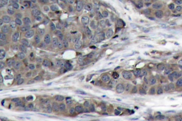 Polyclonal Rabbit anti-Human NFKB1 / NF-Kappa-B Antibody (Asp926, IHC, WB)