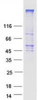 Human SLC2A1 / GLUT-1 Protein (Recombinant Myc-DDK (Flag))
