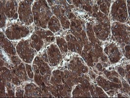 TCL / RHOJ Antibody (clone OTI1C8)