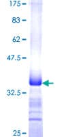 Human MUC5AC Protein (Recombinant GST, N-terminus)