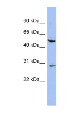 KRT75 / Keratin 75 / K6HF Antibody (N-Terminus)