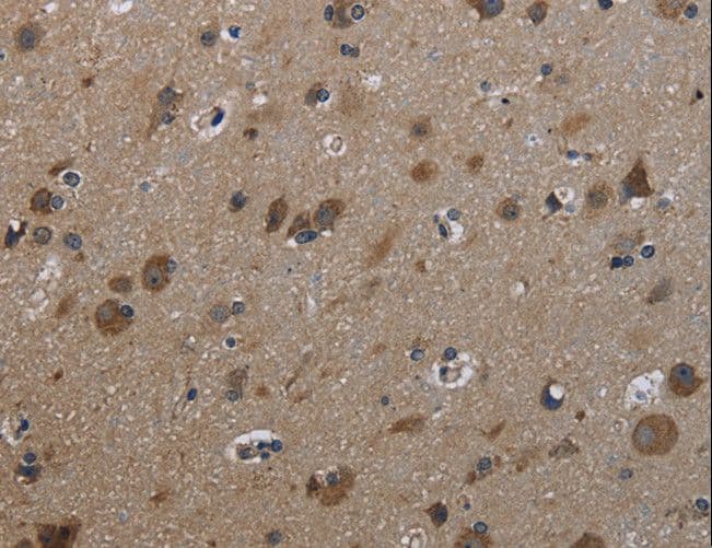 Polyclonal Rabbit anti-Human GSTA3 Antibody (IHC, WB)