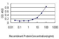 IHC-plus™ Monoclonal Mouse anti-Human Gasdermin D / GSDMD Antibody (clone 3F12-1B2, IHC, IF)