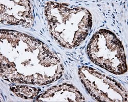 KIAA0153 / TTLL12 Antibody (clone OTI5H3)