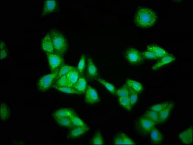 HMGCS2 / HMG-CoA Synthase 2 Antibody