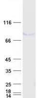 Human TP73 / p73 Protein (Recombinant Myc-DDK (Flag))