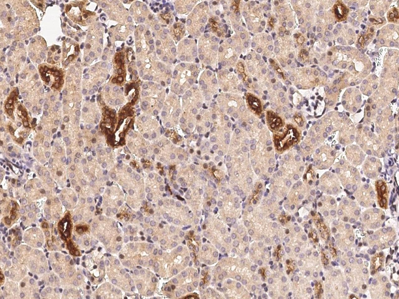 RARB / RAR Beta Antibody (Preservative Free)